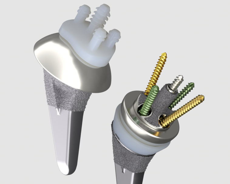 Smith+Nephew announces commercial launch of its AETOS◊ Shoulder System for anatomic and reverse shoulder replacement